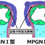 腎臓病　問1～問83　★腎炎関連★