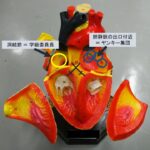 世界一わかりやすい心房細動と肺静脈隔離術のハナシ～治療　前編～